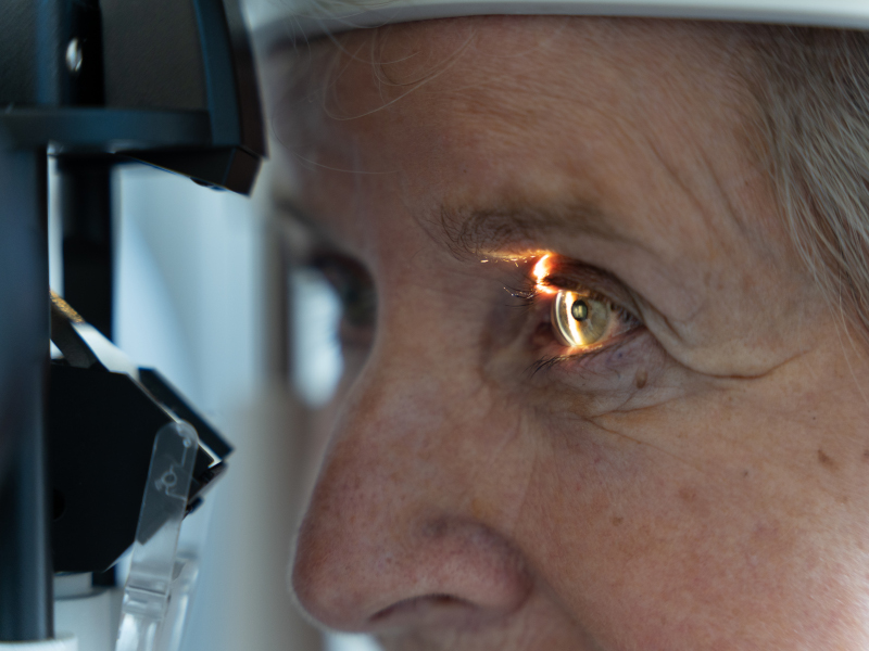 Spaltlampenuntersuchung Spaltlampenuntersuchung